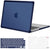 MOSISO Compatible with MacBook Pro 14 inch Case 2025-2021 M4 M3 M2 M1 A3112 A3185 A3401 A2918 A2992 A2779 A2442, Anti-Cracking Heavy Duty TPU Bumper Hard Case&Keyboard Skin&Screen Film, Pink