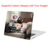 Customize Your MacBook Case